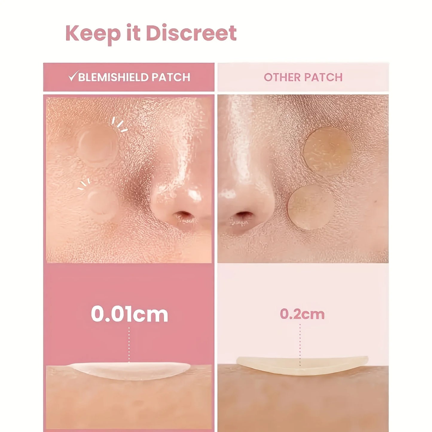 48 PCS Hydrocolloid Acne Patches Provide Invisible Coverage, Facial Acne Patches, Deeply Cleanse Pores and Acne