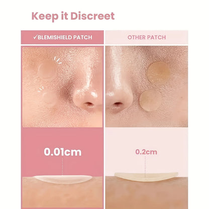 48 PCS Hydrocolloid Acne Patches Provide Invisible Coverage, Facial Acne Patches, Deeply Cleanse Pores and Acne