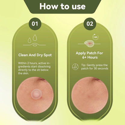 9/100pcs Your Secret to Smoother Skin: Pimple Patches for Hydration & Clarity.