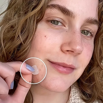 Skin-Calming Acne Patches - Hydrocolloid Technology Gently Heals Blemishes, invisibleProtection.