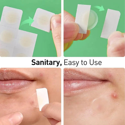 Hydrocolloid acne patch Invisible Hyaluronic Acid Round Acne Patch Blemish Cover Spot Treatment Stickers face skin care